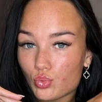 Алексисборедд Голе