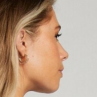 Челси Емили Голе