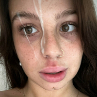 Фиталексис Голе