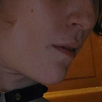 џинџеркитениксикс Голе