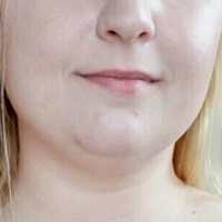 Џесрокс Голе