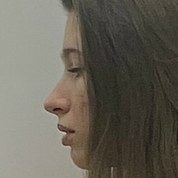 кеттиестетик Голе