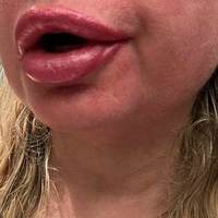 Нина НортСтар Голе