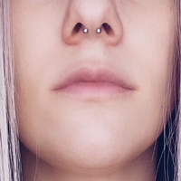 Умбралесцент Голе