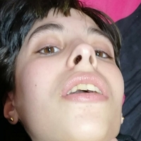 Јоко_Фокси Голе